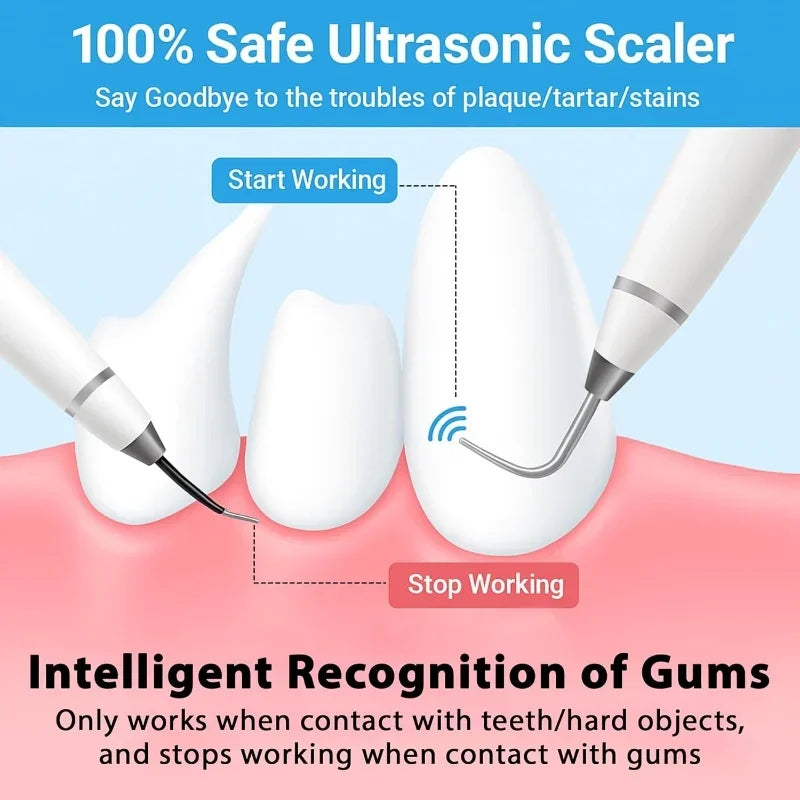 Dog Cat Ultrasonic Dental Scaler Tooth Stone Remover Tool